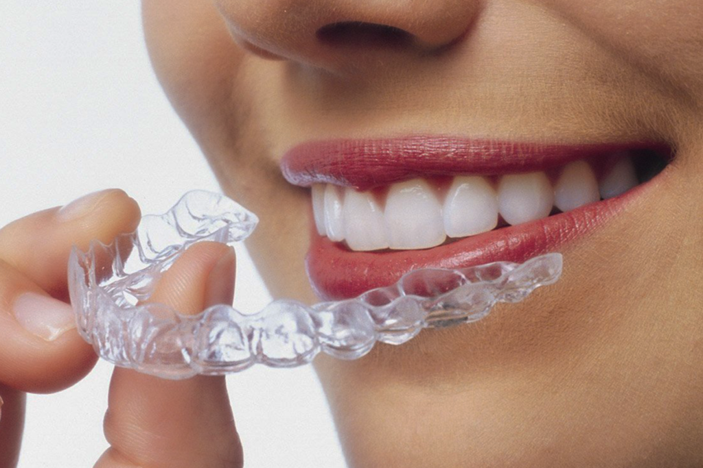 Invisalign